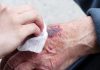 5 Companies In The Wound Healing Market To Watch For In 2019
