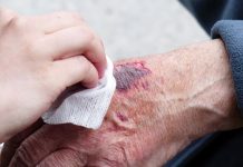 5 Companies In The Wound Healing Market To Watch For In 2019