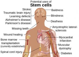 Is Autologous Stem Cell Therapy the next frontier of medicine?
